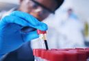 New Blood Test Gives Hope for Early Detection of Parkinson’s Disease