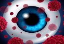 Study Finds New Drug Delivery System Effective in Treating Rare Eye Cancer