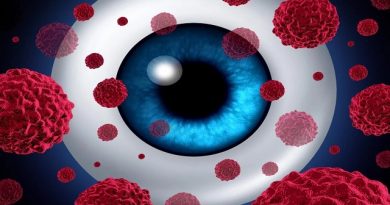 Study Finds New Drug Delivery System Effective in Treating Rare Eye Cancer